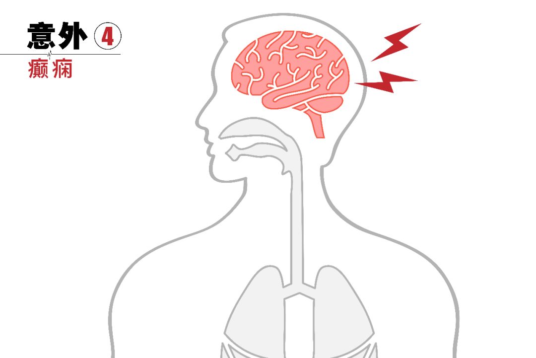 猝死的自救方法几分钟内有效,猝死真就是那样猝不及防吗