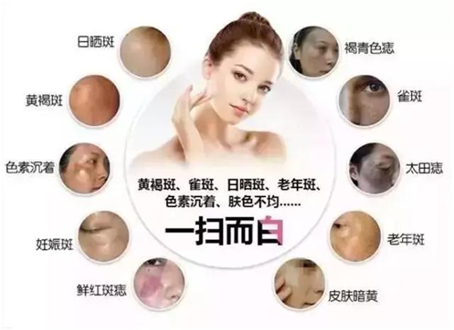 激光美容到底效果如何,激光美容的利和弊是什么