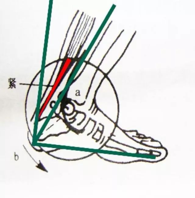 杜兰特对猛龙跟腱受伤视频,伤病猛于虎下一句