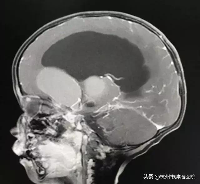 孩子走路不稳是怎么回事,孩子走路不稳有什么办法