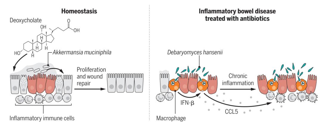 奶酪可以改善肠道吗,奶酪里有酵母菌