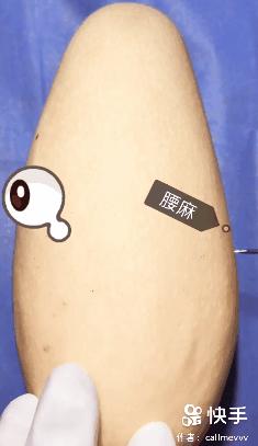 我在快手上看人切洋葱，竟然弄懂了剖腹产？