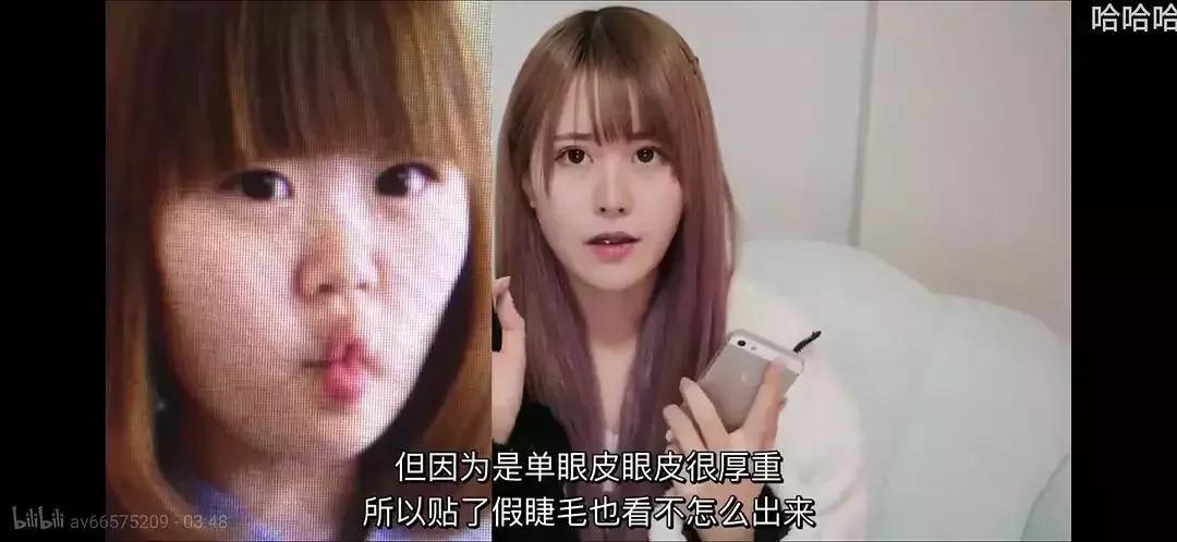 刘梓晨到底有没有整容啊,还记得整容界网红刘梓晨吗