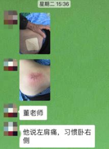 压疮液体敷料怎么用,压疮的治疗首选敷料