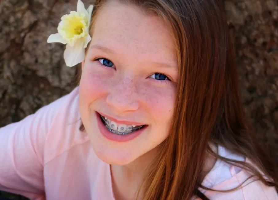 一次搞定雀斑的秘方绝招公开,长了雀斑很难看有一个小妙招