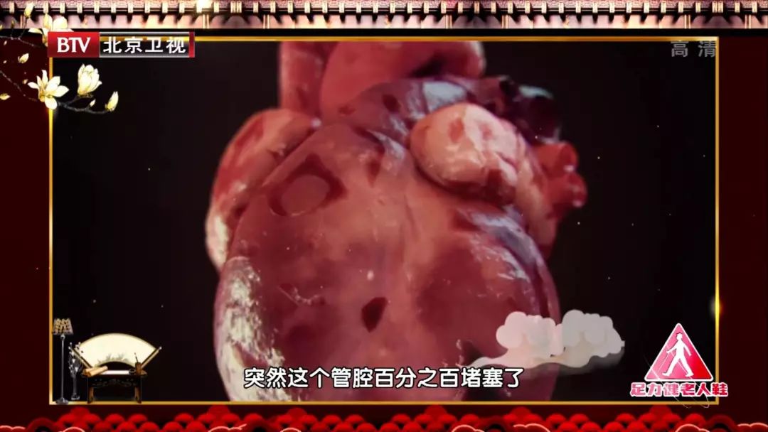 颈动脉有斑块五个办法解决,颈动脉斑块怎么办应该注意什么