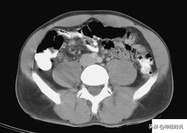 肾脏输尿管膀胱前列腺结构,肾输尿管膀胱解剖示意图