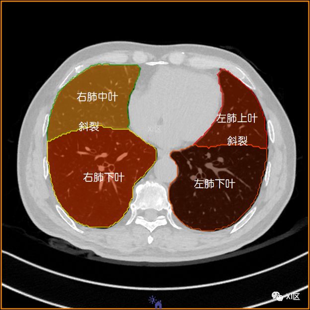如此详细的肺部影像解剖，有点儿酷