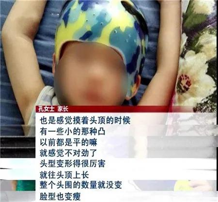 老人睡扁头是怎么回事,为什么老人非要给孩子睡扁头