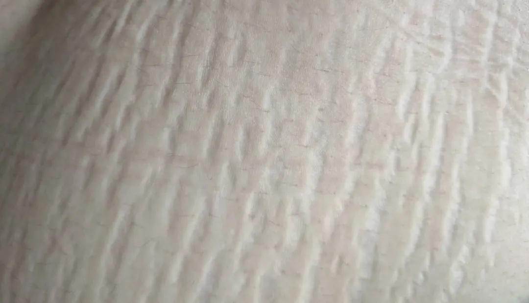 那些号称可以预防妊娠纹的乳油膏霜，原来都是智商税