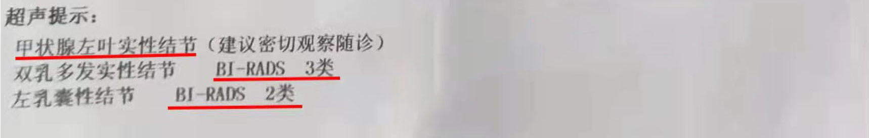 甲状腺结节有什么不同样的症状,甲状腺结节并腺瘤