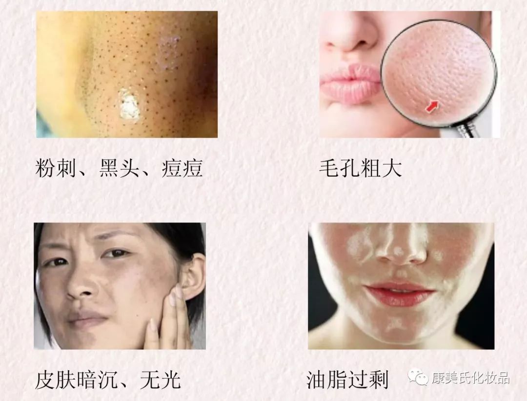 冰岛蓝湖硅藻泥面膜,冰岛硅藻泥面膜