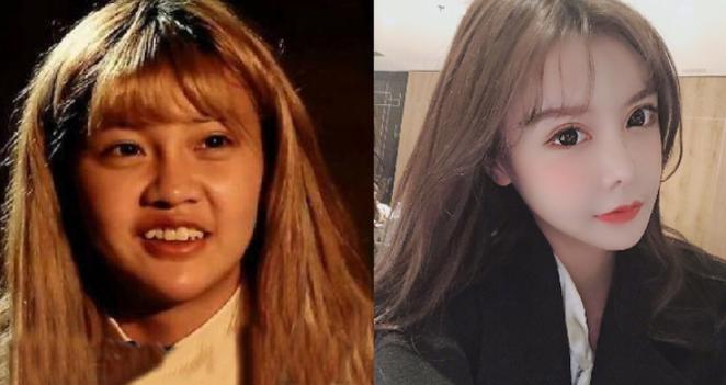 baby戴眼罩,baby鼻梁变化