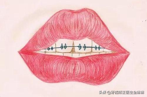 30岁牙齿牙缝大矫正一般多少钱,牙缝大牙齿松了怎么办