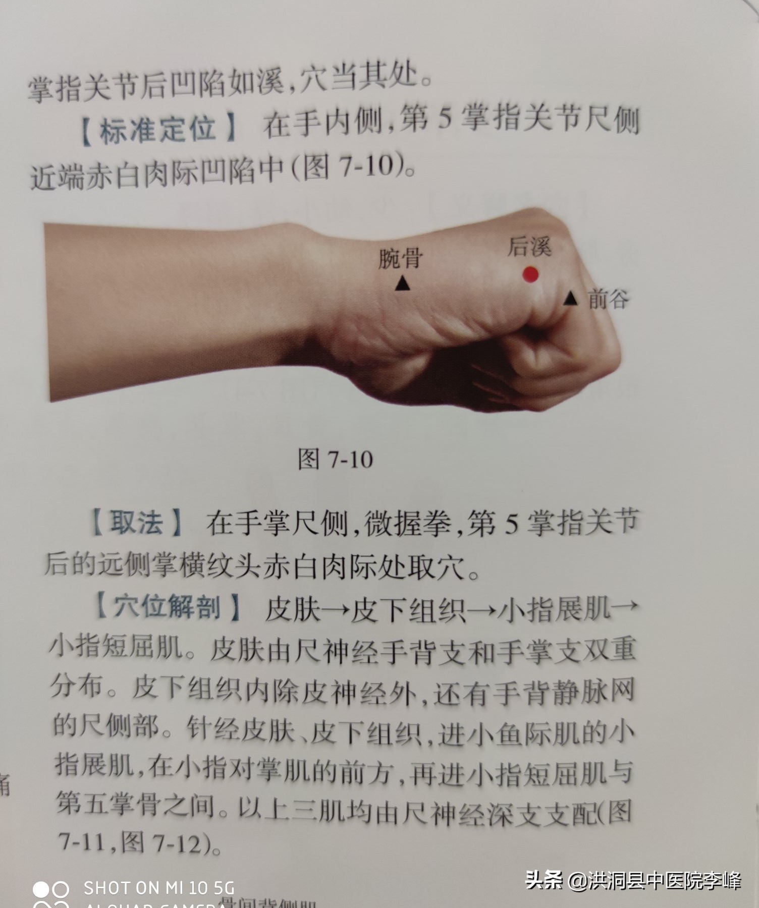 常见痛症“针刺运动疗法”特定取穴