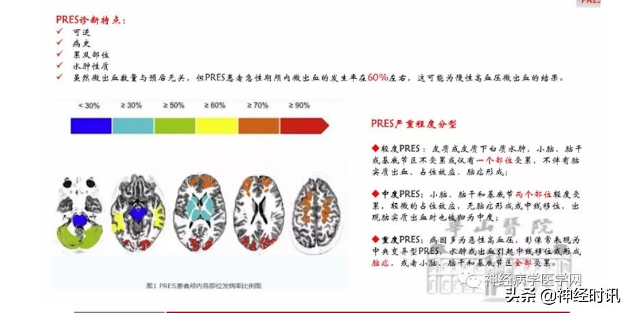 缺血性脑血管病出血评估,脑血管微出血怎么治疗