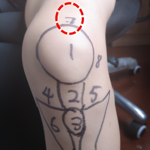 不同膝盖疼痛是暗示什么,不同位置的膝盖疼