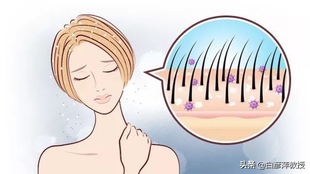 头发半天就油了怎么回事,脂溢性皮炎会出现丘疹吗