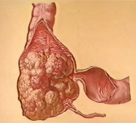 拉不出便便怎么办,拉不出便便怎么办该买什么