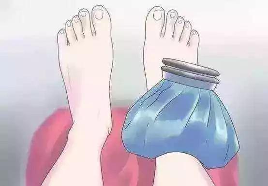 运动踝关节扭伤,踝关节扭伤崴脚