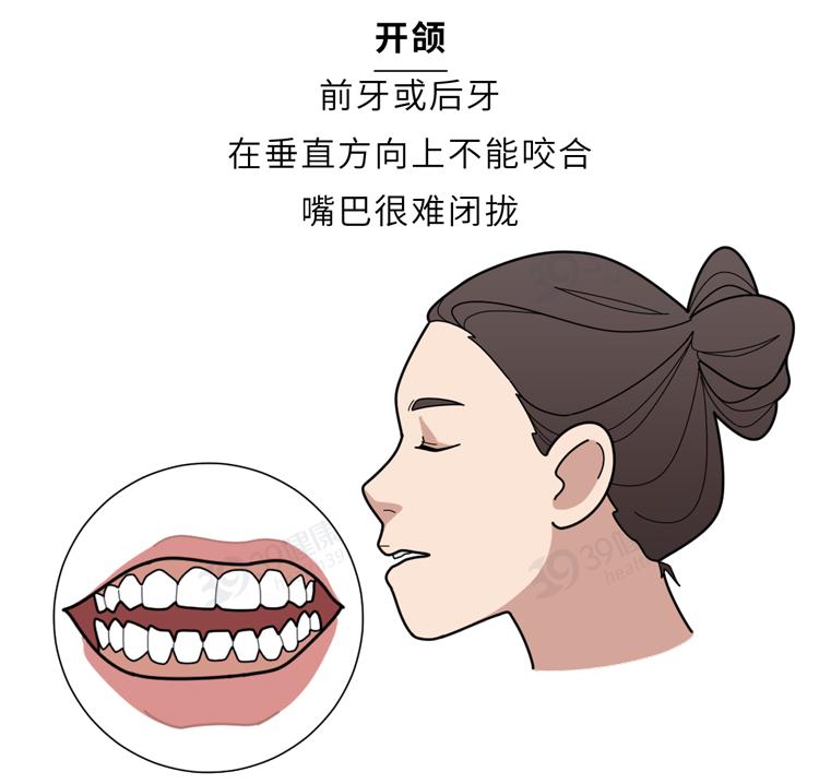 隐形牙套能矫正整齐吗,为什么戴牙套会让人变好看