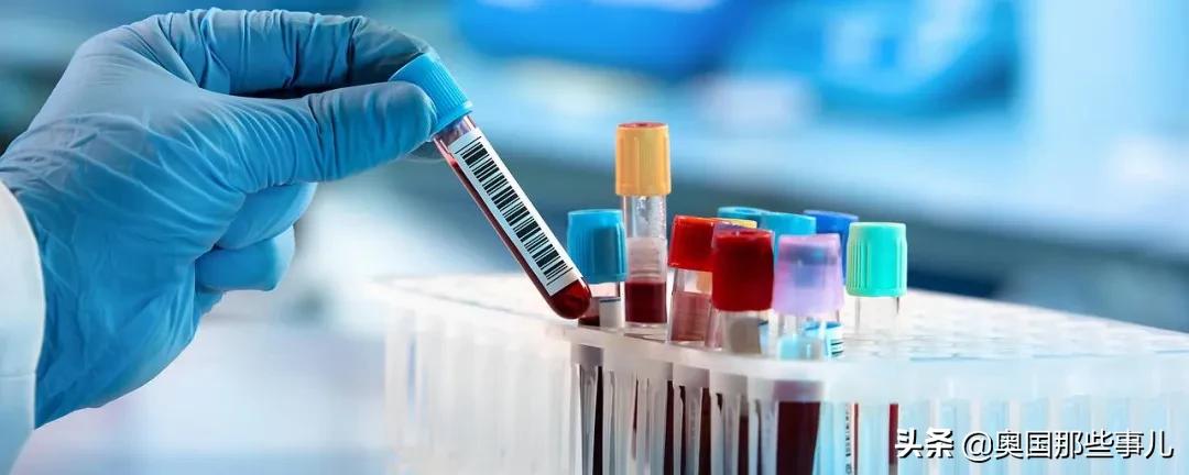 如果没有这位奥地利人，新冠病毒抗体测试将无从谈起！