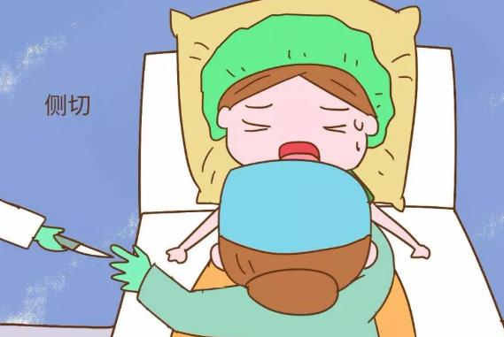 产妇顺产侧切的多吗,10个孕妇几个顺产几个剖宫产