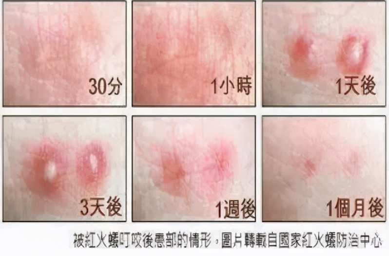 红火蚁入侵南方地区有什么影响,外来危险物种入侵红火蚁