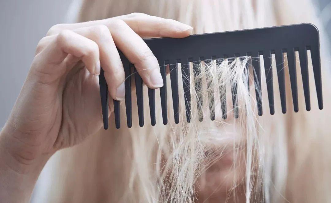 白头发很多显老怎么办,无需染发能使白发变黑发的秘诀