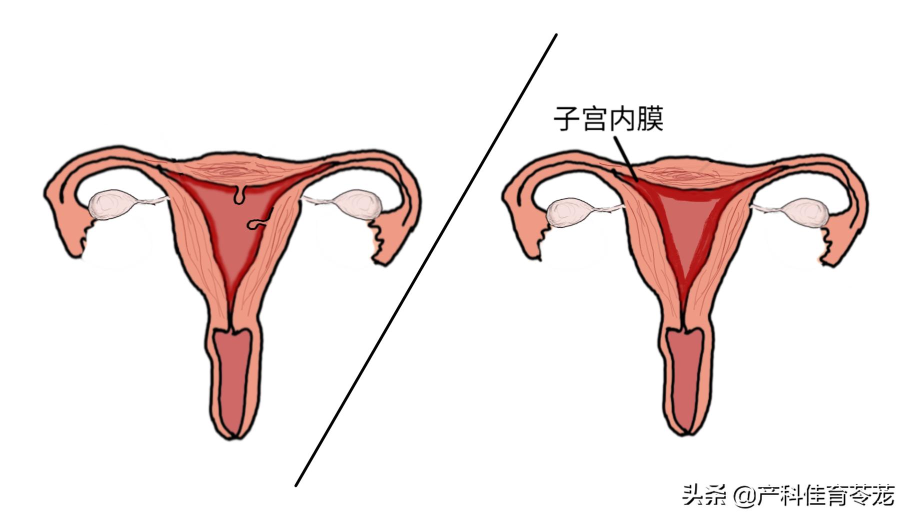 月经不调延后如何调理月经量少,月经不调不正常量少