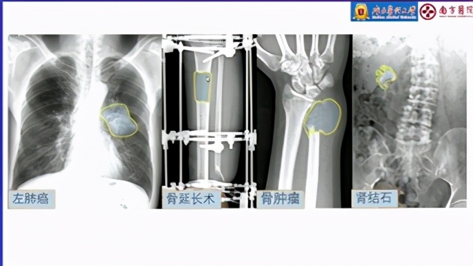 就业率最高的专业排名前十,就业热门专业排名前十名