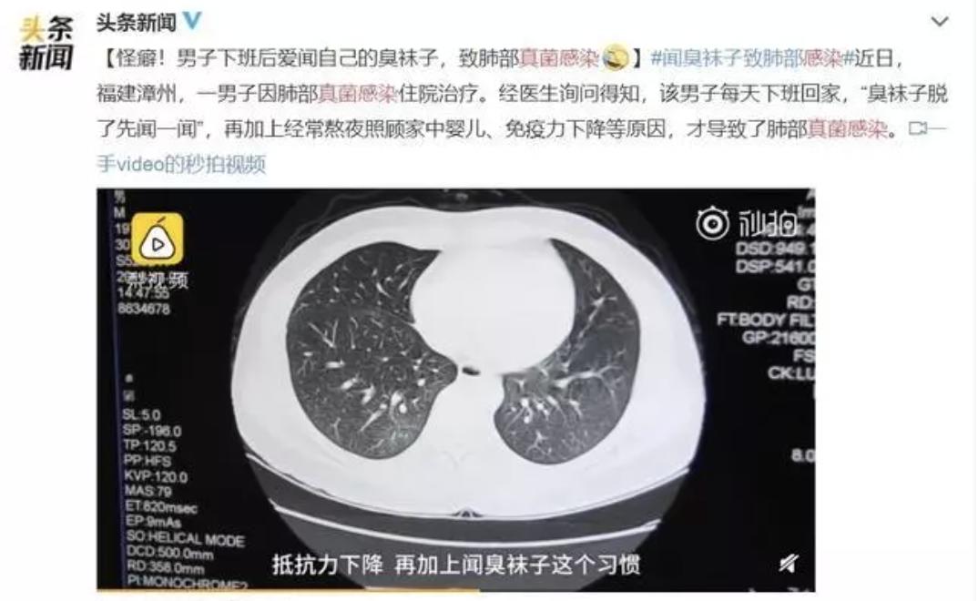 为什么喜欢闻自己的脚臭,狐臭口臭脚臭屁臭