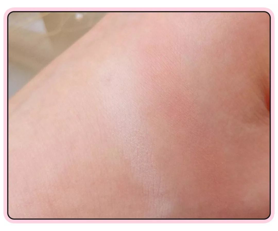 五级瘦脸都拯救不了的脸型,科学瘦脸法真的能改变脸型吗