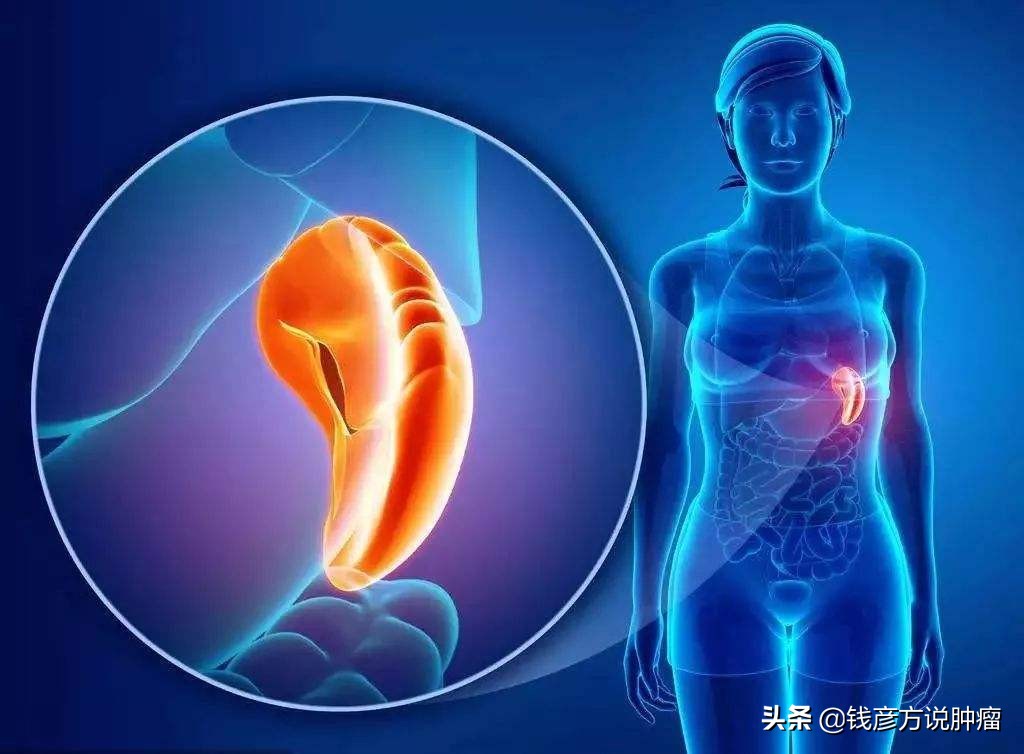 中医治疗肿瘤，常提到的“虚”字，原理是什么，又该怎么治疗？