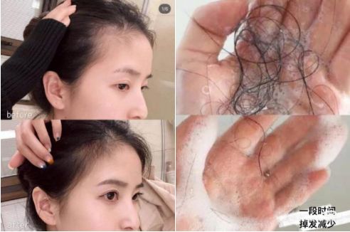 90后怎么防脱 (90后该如何防脱)