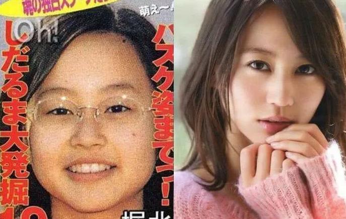 日本双眼皮整形视频,日本整容大师演示