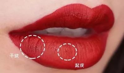 嘴唇不再干燥起皮温和润唇,秋冬唇干燥起皮