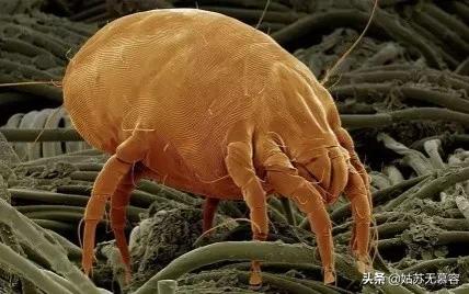 治螨的最好方法,怎样除螨避免过敏