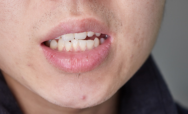 老是嘴巴干喝水也不管用,喉咙发干喝水也不能缓解