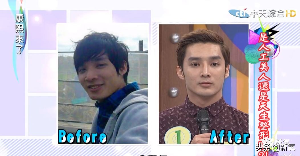 花90万从头整到脚，还可以这么自然？旁边纯天然小姐姐都看懵了