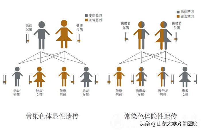 齐鲁医院有遗传咨询科吗,济南齐鲁医院遗传病科