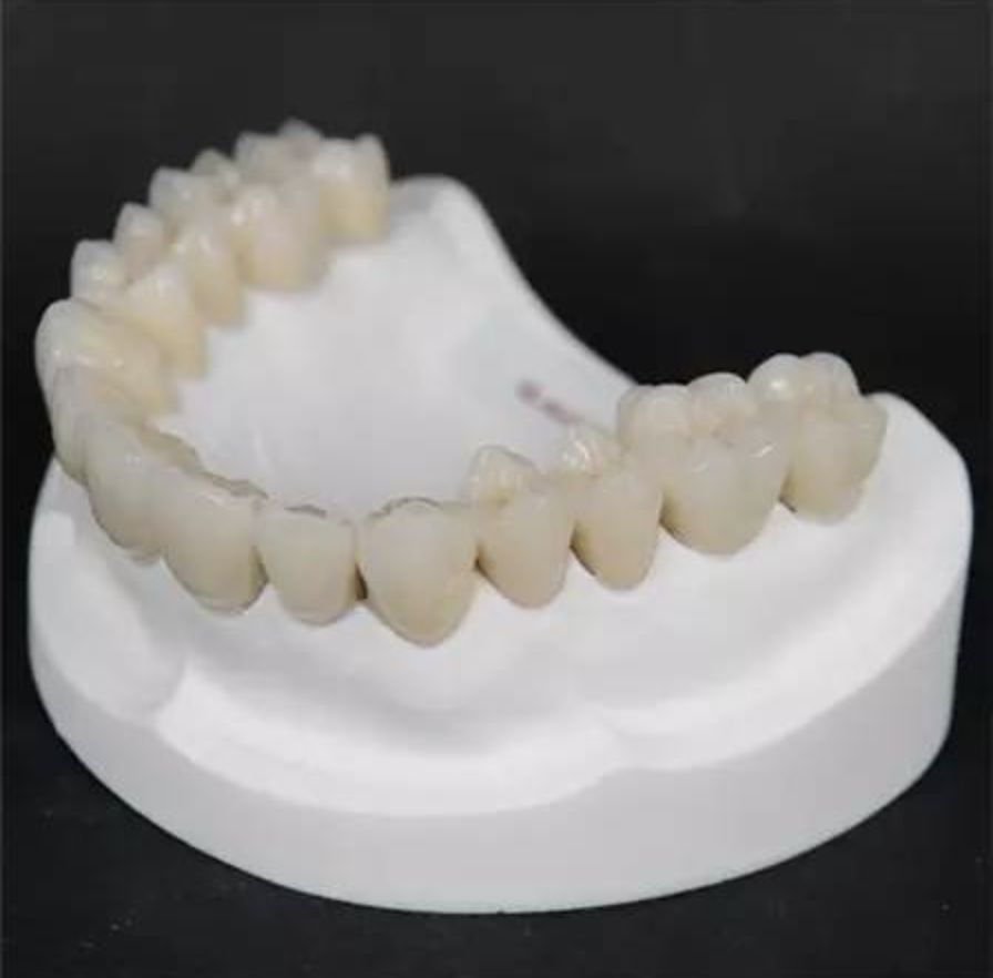 烤瓷牙和全瓷牙的价格相差多少,全瓷牙和烤瓷牙价格上相差多少