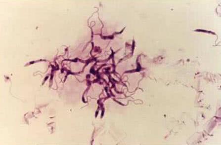 如果没有进化论人是怎么出现的,进化论不能完美地阐述生物的起源