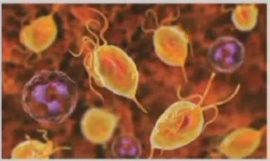 阴道炎怎么反复治不好,阴道炎反复发作治不好