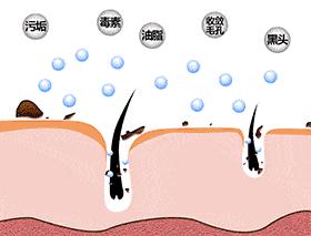 鼻头毛孔粗大如何改善缩小毛孔,皮肤毛孔粗大出汗可以缩小毛孔吗