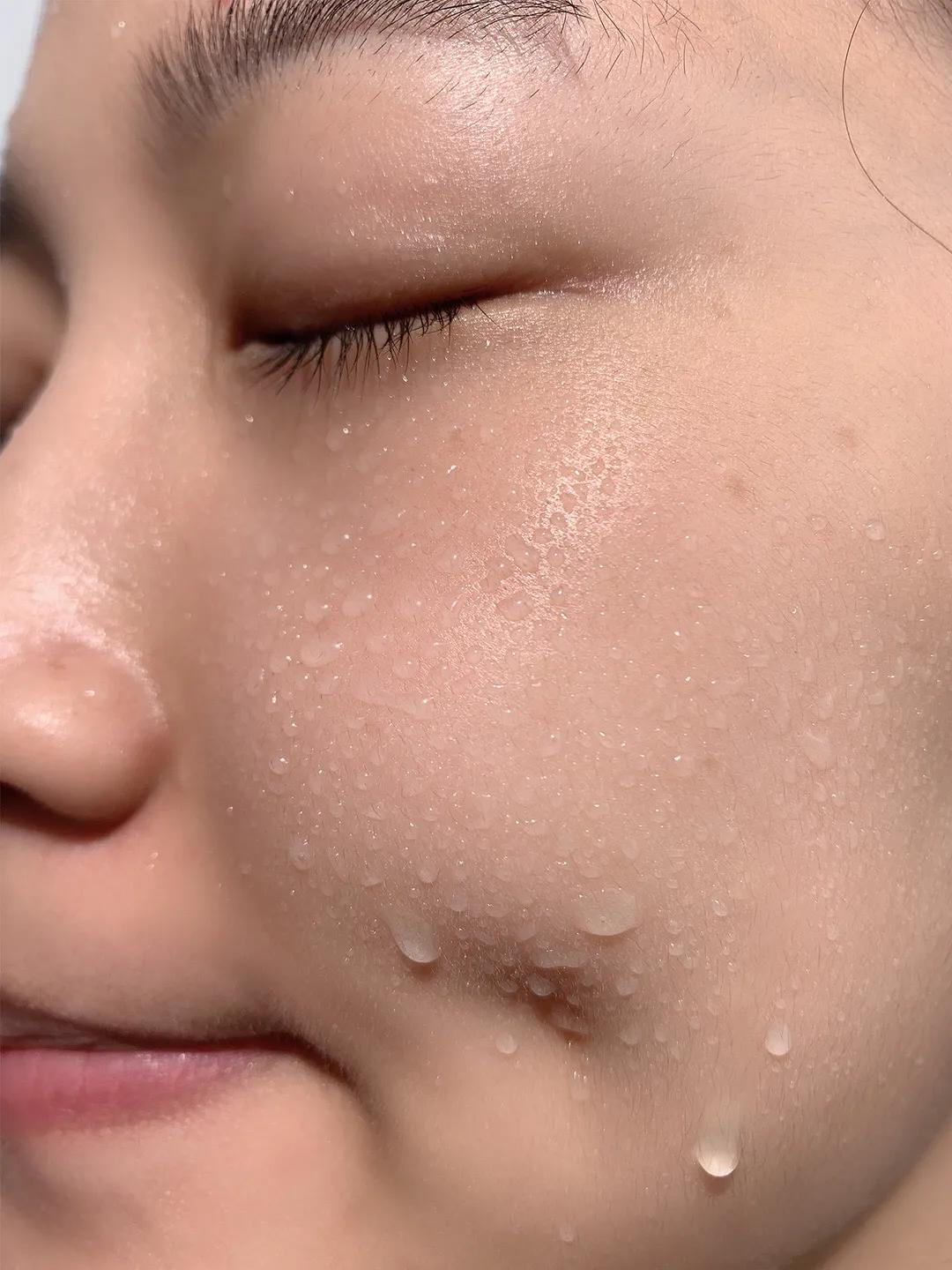 女孩青春期皮肤粗糙如何改善,青春期怎样让皮肤变得细腻