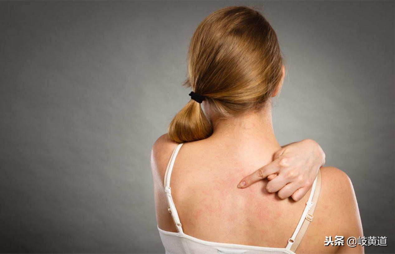 皮肤起红疙瘩荨麻疹怎样治疗,为什么皮肤发红疹荨麻疹不能治好