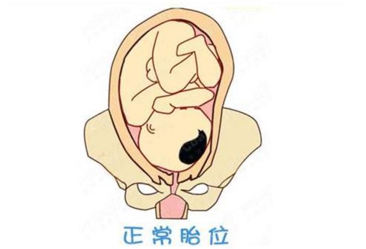 顺产也是有门槛的,孕妈想顺产,先看看自己满不满足这4个条件