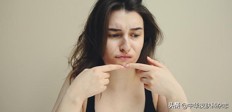 祛痘印痘疤最有用的药膏,激光祛痘印痘疤效果好吗