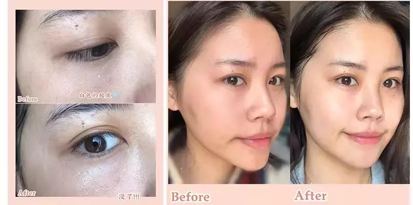 新西兰水光面膜,新西兰8分钟面膜三种颜色的功效